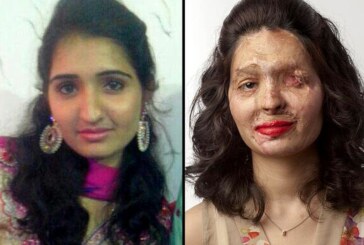 Una mujer atacada con ácido desfilará en la NY Fashion Week