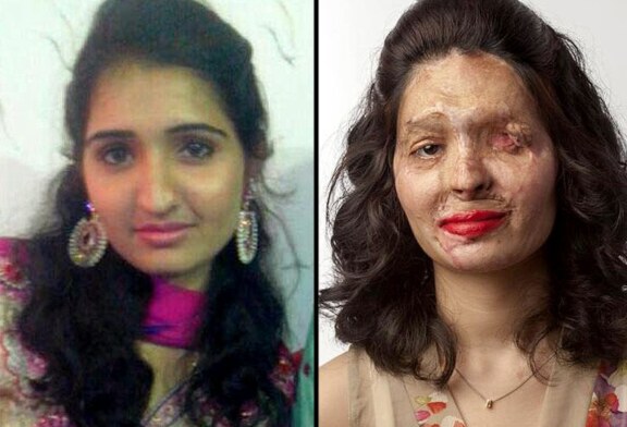 Una mujer atacada con ácido desfilará en la NY Fashion Week